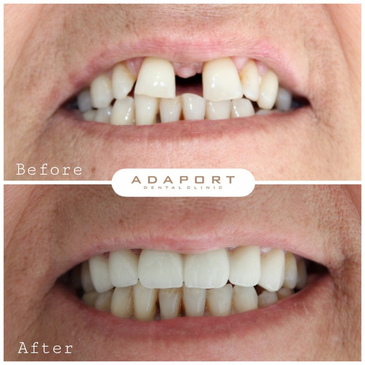 Slider image (4) Adaport Dental Clinic